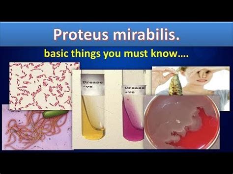 proteus mirabilis|Proteus mirabilis Overview .